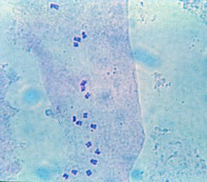 cellule haploïde d'un apex racinaire avec ses 17 chromosomes