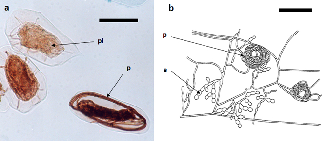 Figure 3 : champignons symbiotiques des orchidées (a) - trois cellules racinaires de Cephalanthera damasonium dilacérées et colonisées par un champignon (Thelephora sp.) à différents stades (b). Mycélium asexué de Tulasnella sp., un symbiote d'orchidée, en culture pure. Abréviations : p, peloton de filaments fongiques intracellulaire ou spontanément formé en culture pure; pl, peloton âgé et lysé (détruit); s, chaînette de spores asexuées. La barre représente 0,1 mm; photo de U. Puttsepp (Univ. de Tartu, Estonie) (a) et dessin repris de N. Bernard (b).