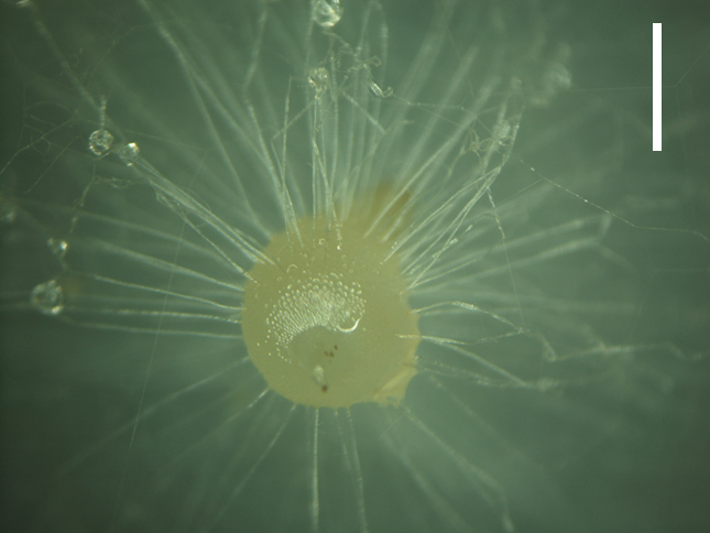 Figure 4 : protocorme asymbiotique de Dactylorhiza majalis. La barre représente 5 mm; photos de G. Wojtczak et K. Turnau (Univ. de Cracovie, Pologne).