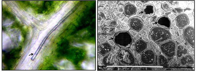 Photos en microscopie électronique mettant en évidence la cavitation ou l’embolie chez les plantes. A gauche, vaisseaux cavités dans le limbe d’une feuille de noyer. A droite, vaisseaux cavités dans le xylème de la tige - © Hervé Cochard