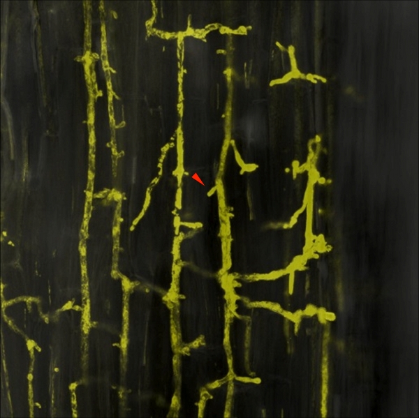Figure 2 : Développement d’un Phytophthora palmivora fluorescent (jaune) au sein d’une racine de Medicago truncatula. Les courtes ramifications perpendiculaires aux hyphes sont appelées haustoria (flèche rouge) - © Dr. Thomas Rey, Schornack Lab, Sainsbury Laboratory, University of Cambridge